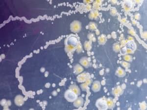 Alternaria Tenuis Alternaria Tenuis